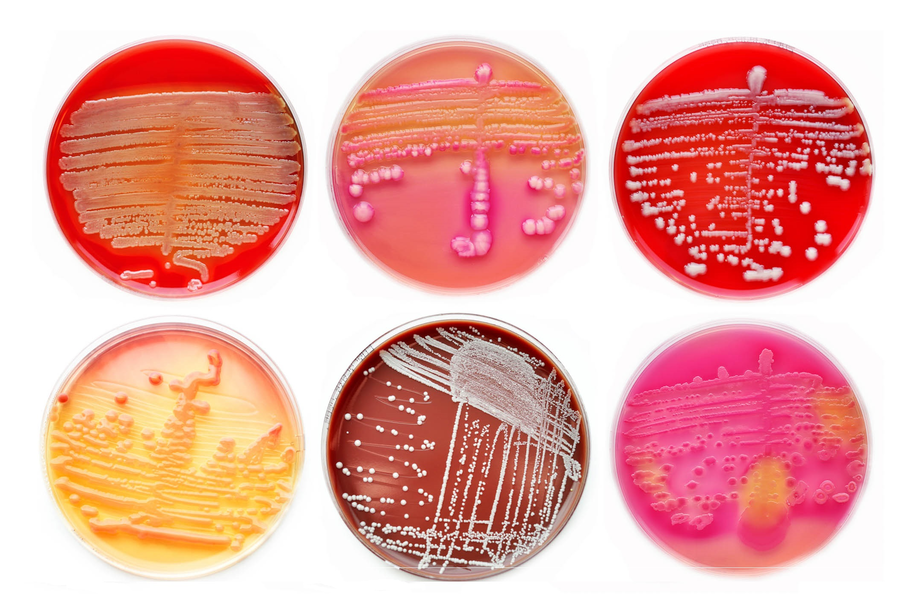 Microbial Risk Management During Cleanroom Operations